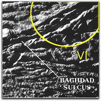 Baghadad Sulcus